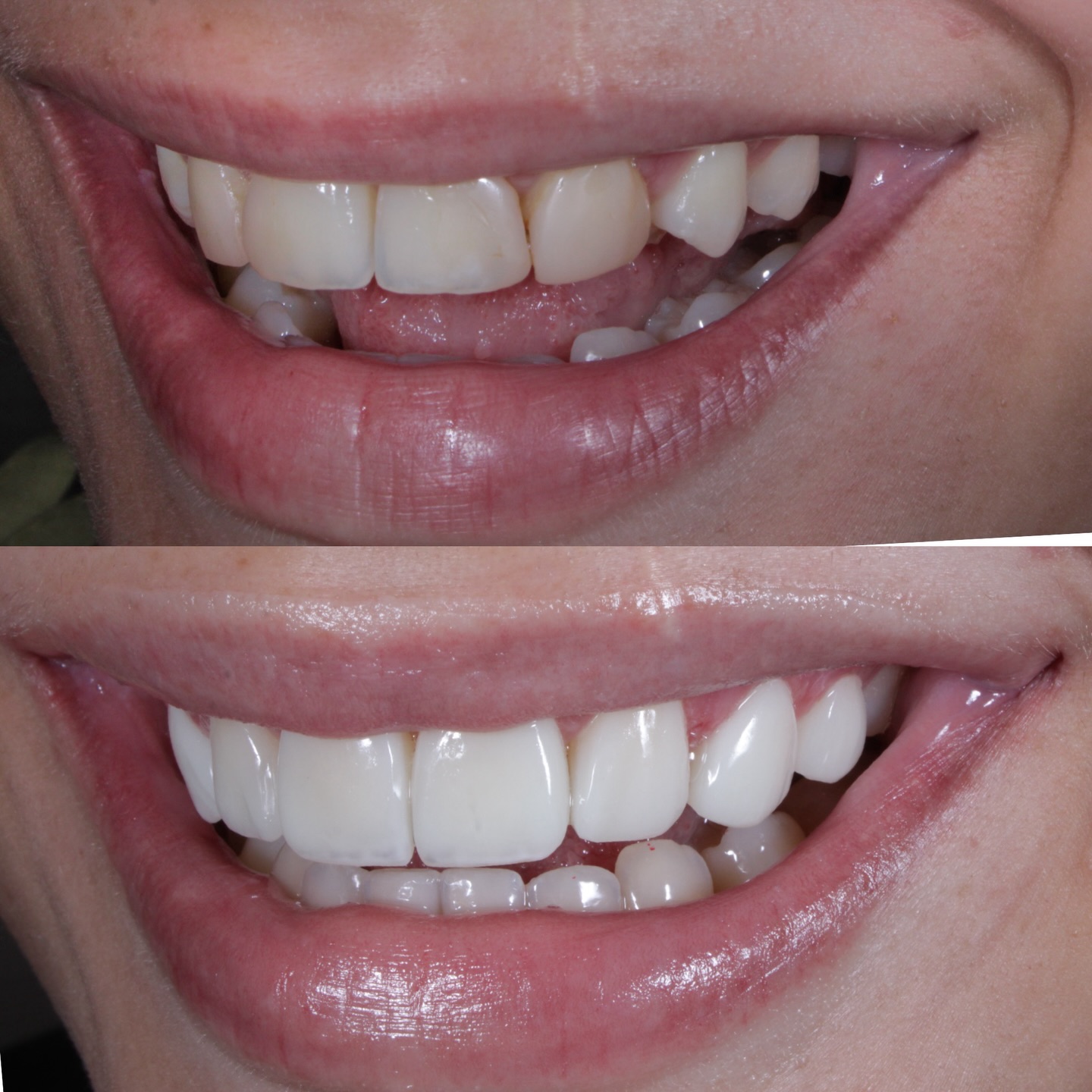 Antes e depois 2