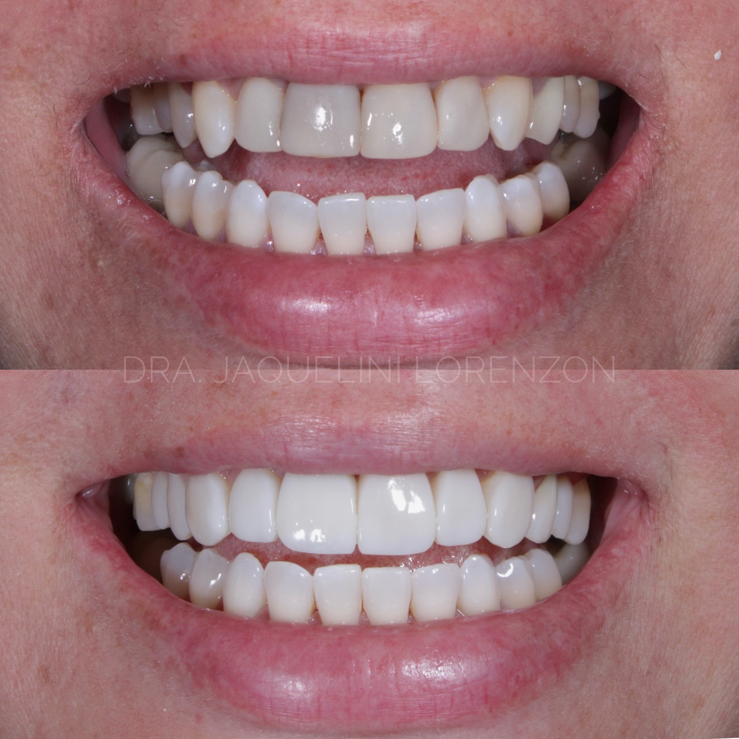 Antes e depois 3