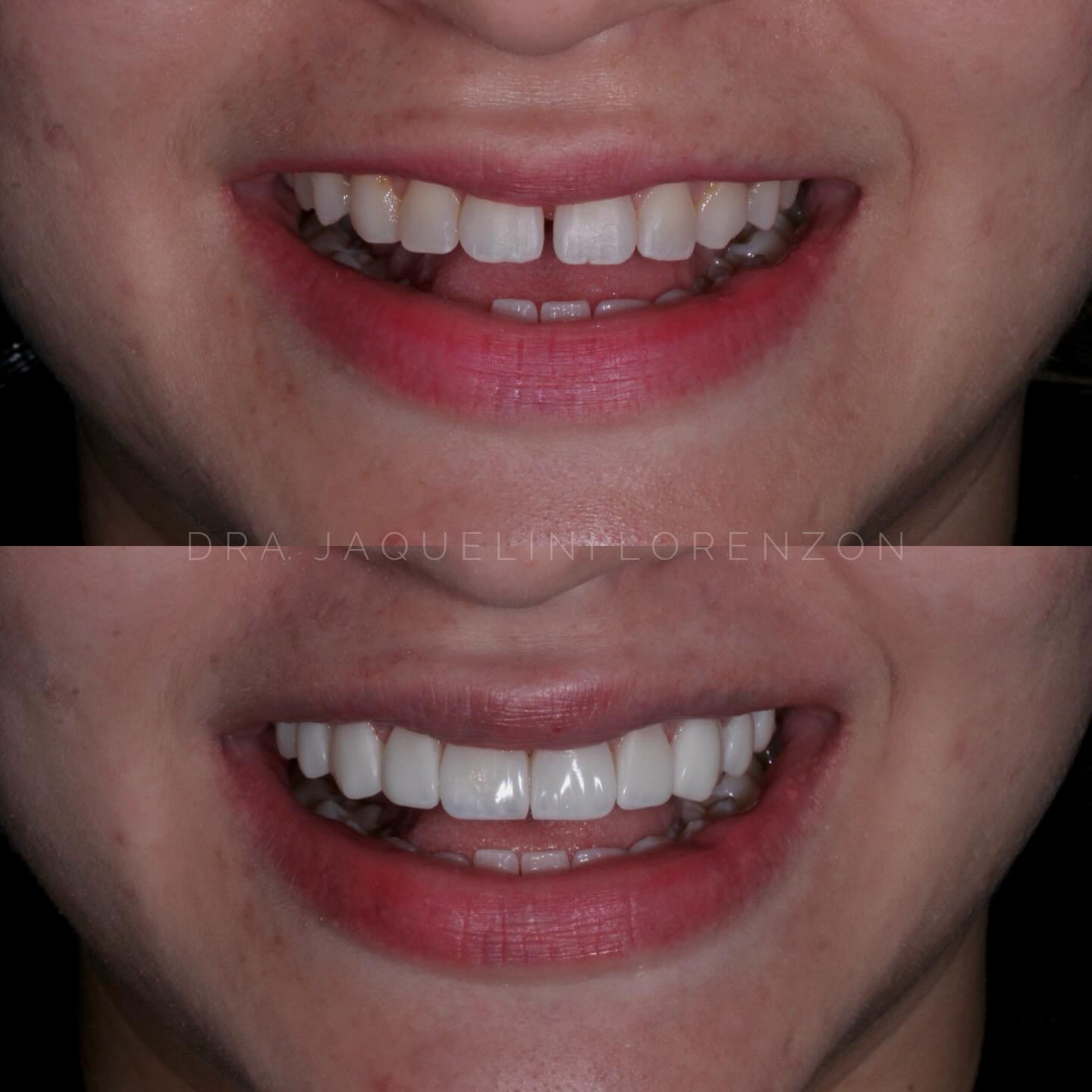 Antes e depois 4
